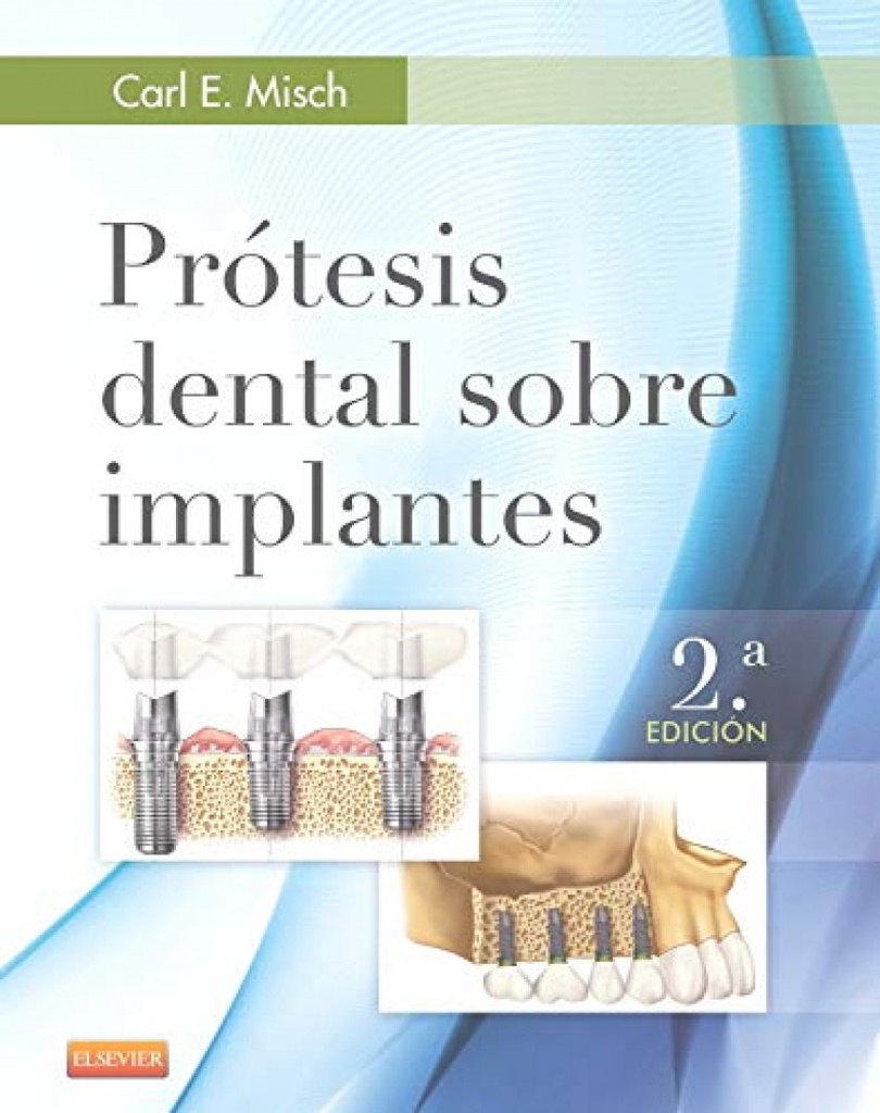 [9788490228630] Protesis Dental Sobre Implantes