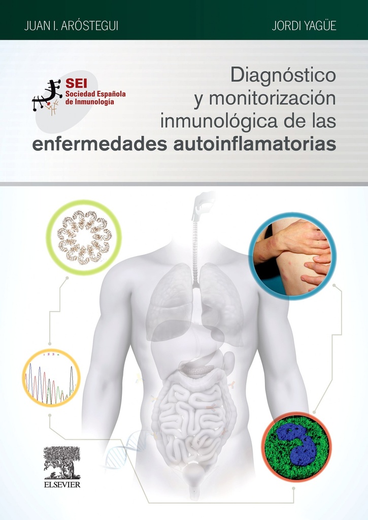 [9788491131076] Diagnóstico y Monitorización Inmunológica de las Enfermedades Autoinflamatorias
