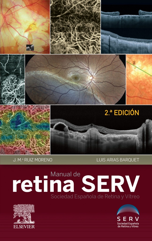 [9788491135647] Manual de Retina Serv