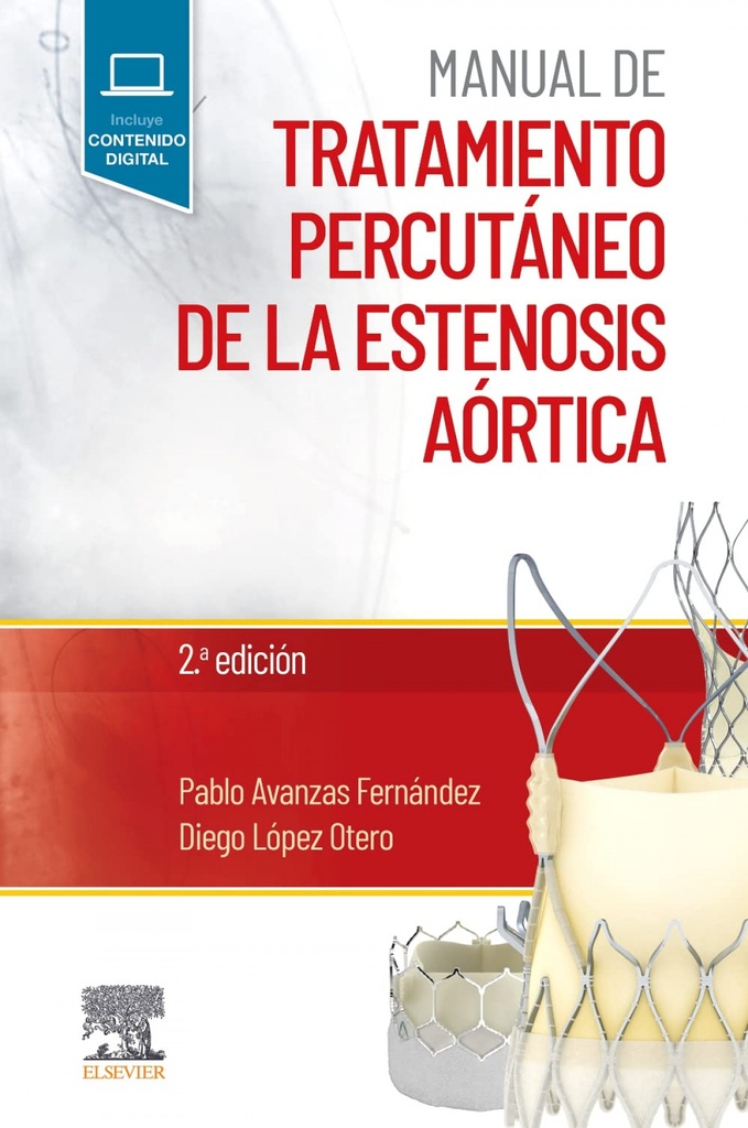 [9788491138921] Manual de tratamiento percutáneo de la estenosis aórtica