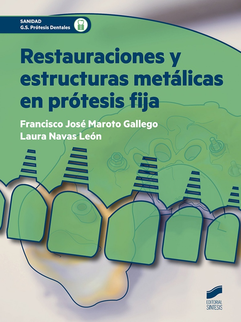 [9788491710172] Restauraciones y Estructuras Metalicas en Protesis Fija