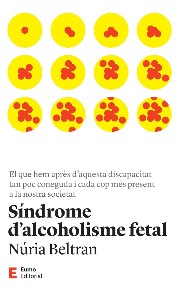 [9788497668149] Síndrome d'alcoholisme fetal