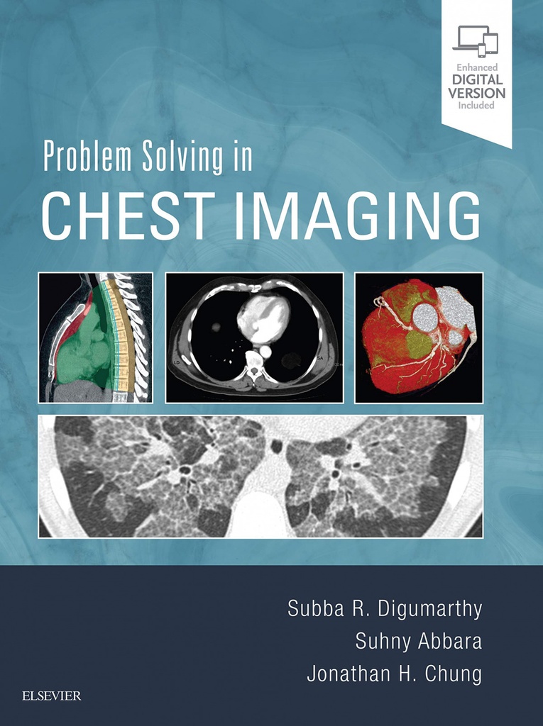 [9780323041324] Problem Solving in Chest Imaging