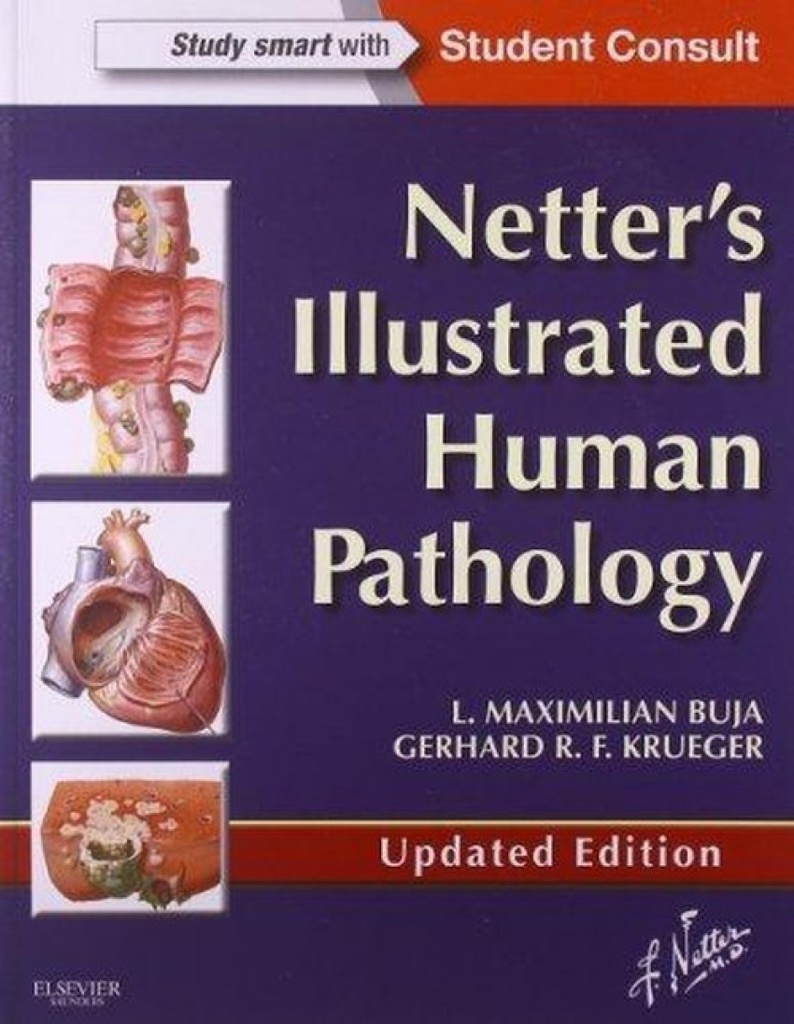 [9780323220897] Netter's Illustrated Human Pathology Updated Edition