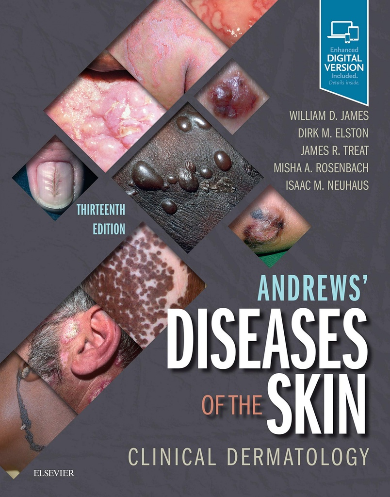[9780323547536] Andrews´ Diseases of the Skin