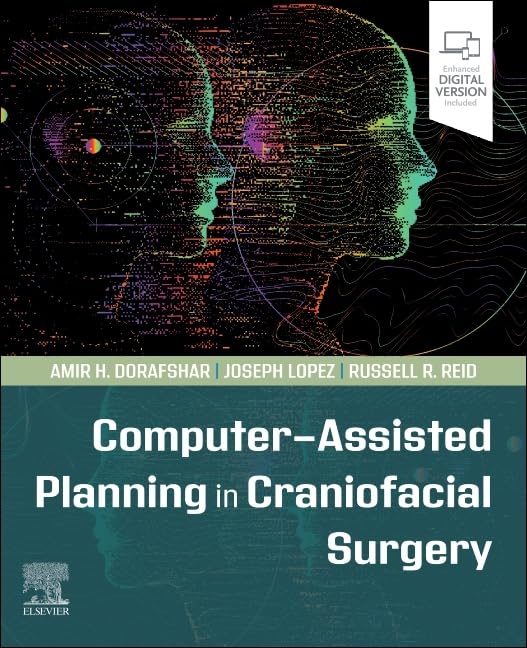 [9780323826686] Computer-assisted planning in craniofacial surgery