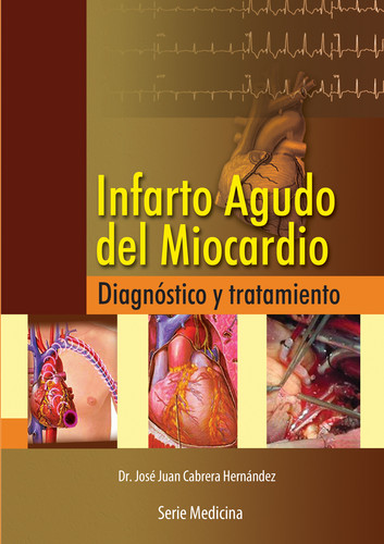 [9789592375949] Infarto Agudo del Miocardio