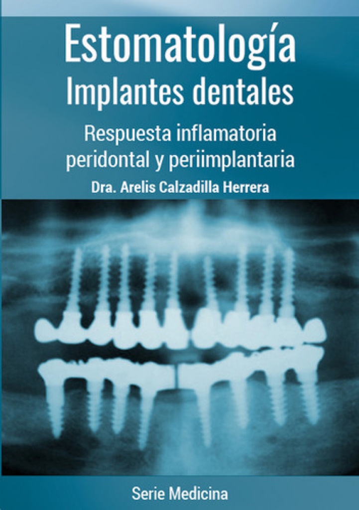 [9789592376267] Estomatología. Implantes Dentales