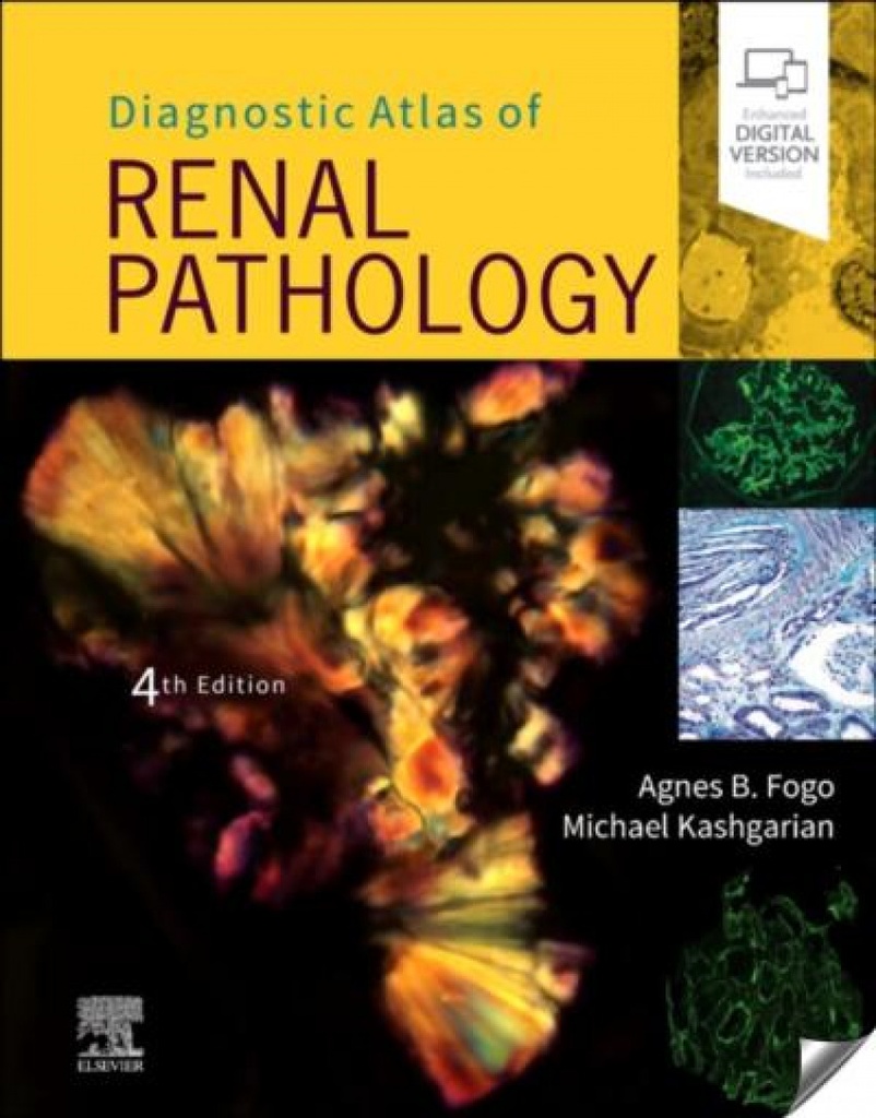 [9780323721639] Diagnostic atlas of renal pathology