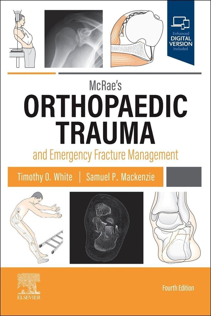 [9780323846820] Mcrae's orthopaedic trauma emergency fracture management