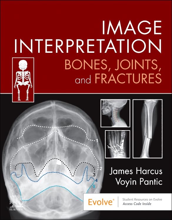 [9780323870801] Image interpretation:bones, joints, and fractures