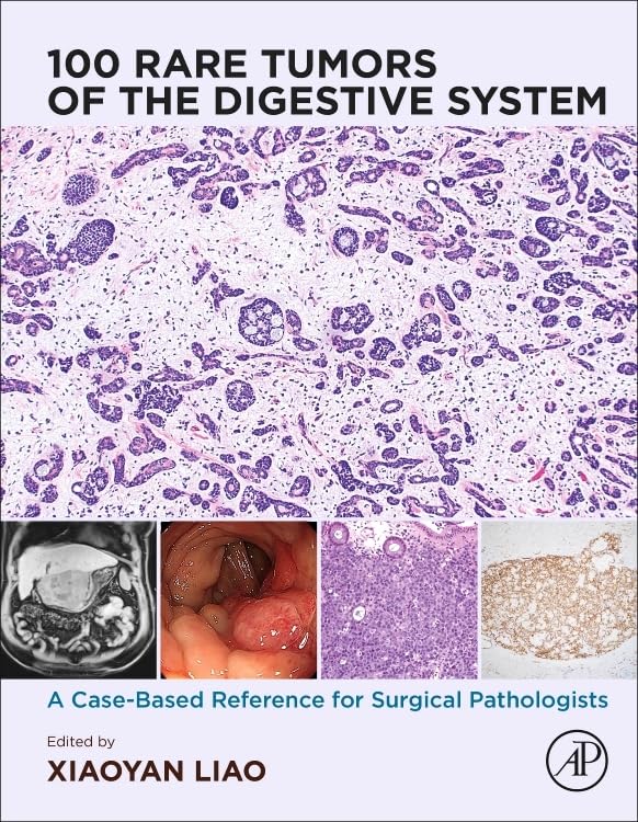 [9780443220616] 100 rare tumors of the digestive system