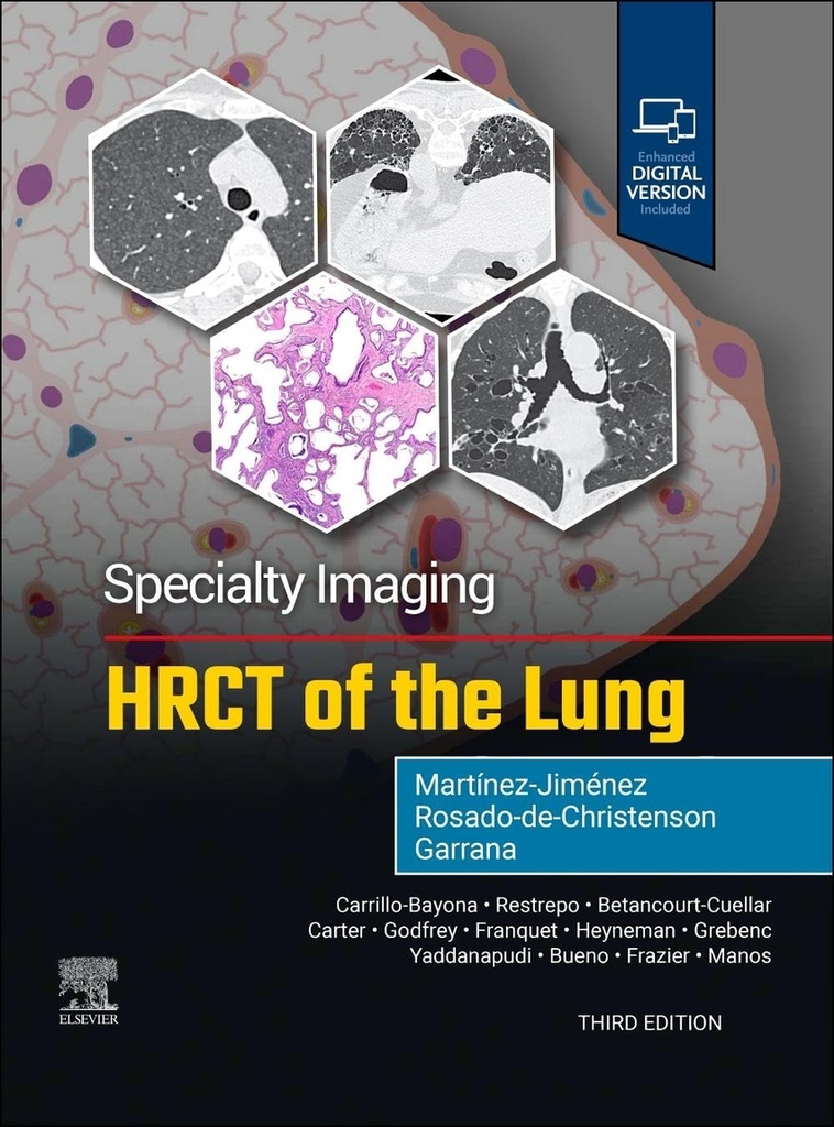 [9780443286360] Specialty imaging:hrct of the lung