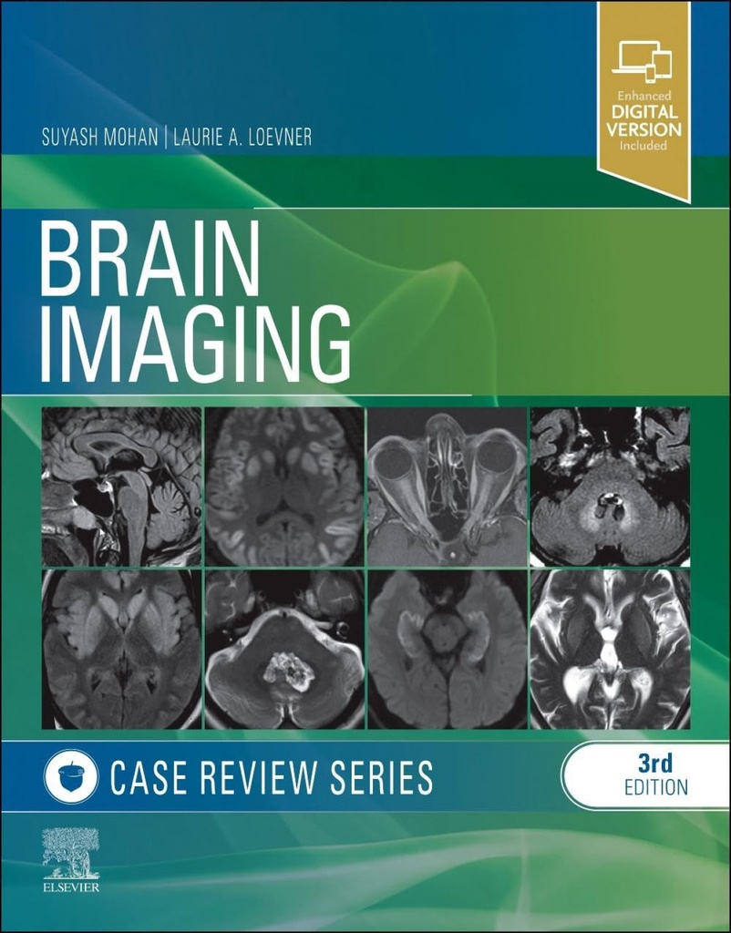 [9781455774852] Brain imaging: case review series