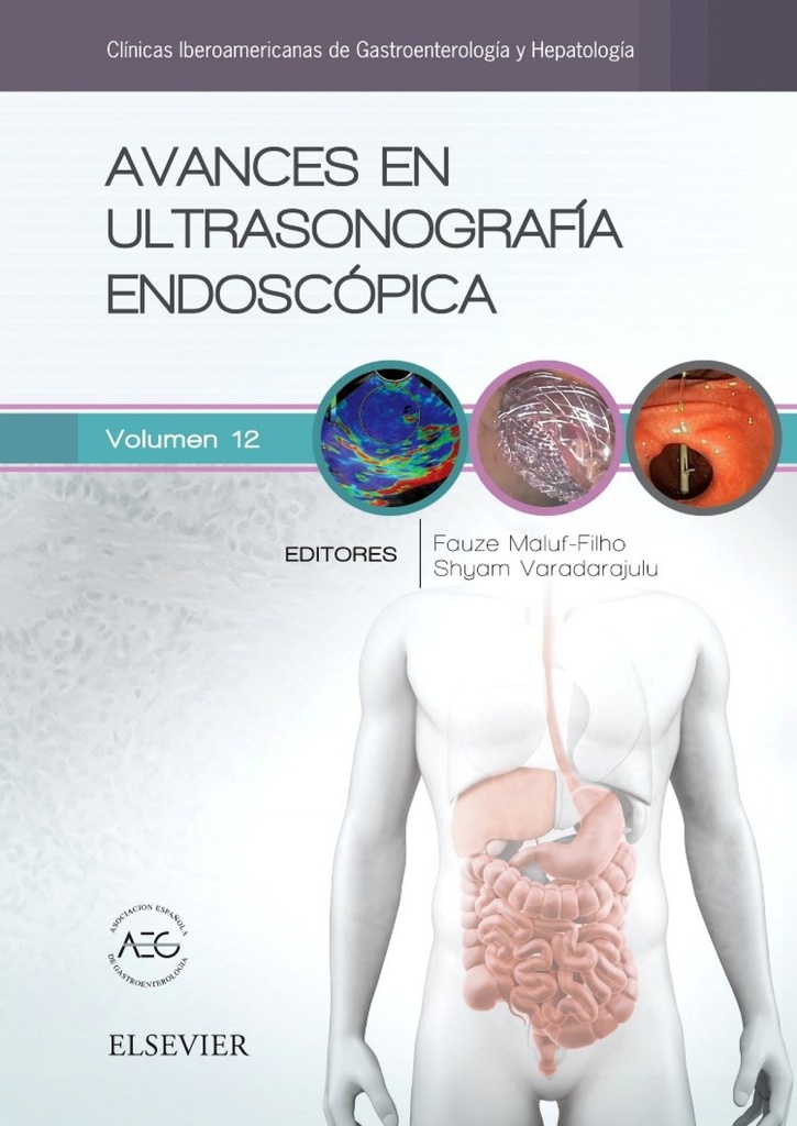 [9788491131748] AVANCES EN ULTRASONOGRAFÍA ENDOSCÓPICA