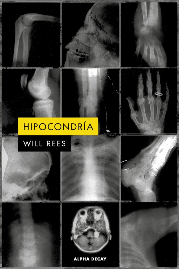 [9791399056471] HIPOCONDRÍA