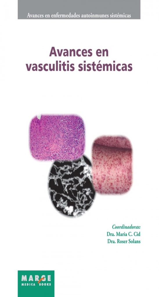 [9788415340218] Avances en Vasculitis Sistemicas